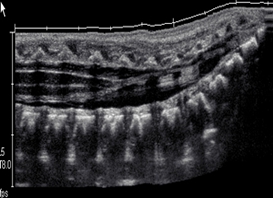 Diagnostic Medical Sonography (Ultrasound) at Oregon Tech